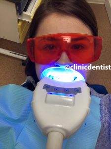 Фотоотбеливание зубов Amazing White США