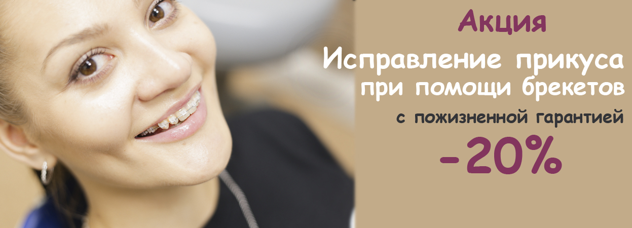 Акция брекеты