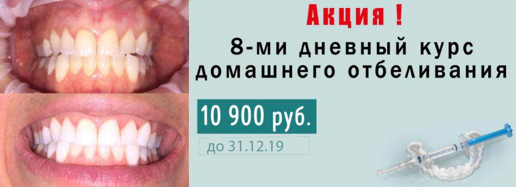 Отбеливание акция-31.12