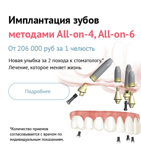 Компьютерная томография зубов на Коломенской